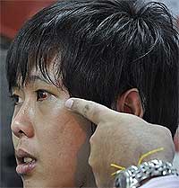 koh chon weng police brutality victim black eye 070609 05